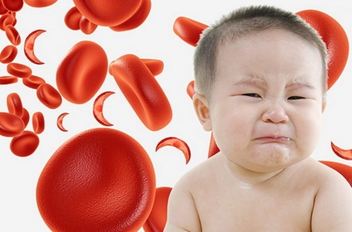 Thiếu máu, thiếu sắt ở trẻ em  ảnh hưởng lâu dài trên thể chất, trí tuệ