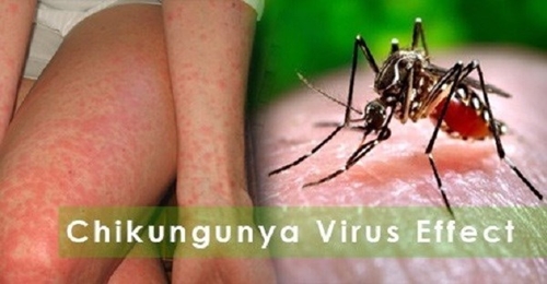 Mỹ phê duyệt vaccine ngừa virus chikungunya đầu tiên trên thế giới