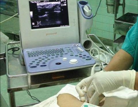 Áp dụng thành công kỹ thuật mới trong gây mê phẫu thuật cho bệnh nhân suy tim nặng giai đoạn cuối