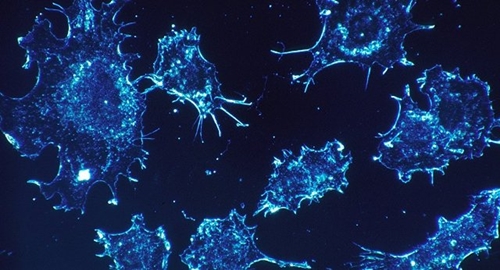 Xét nghiệm mới phát hiện 8 loại ung thư giai đoạn sớm