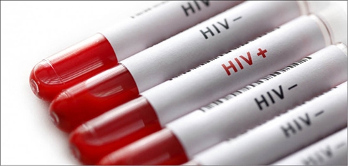 Số trường hợp nhiễm HIV tăng cao ở Đông Âu