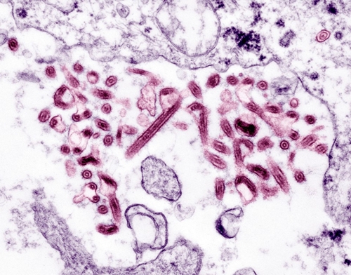 Ebola hứa hẹn được điều trị hiệu quả từ kết quả thử nghiệm tại Congo