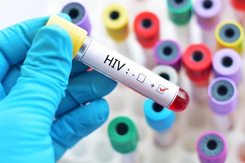 Cảnh báo về sự gia tăng các trường hợp nhiễm HIV AIDS ở Mỹ Latinh