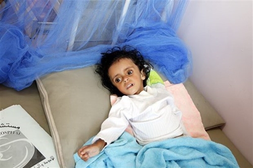 5 triệu người Yemen “chỉ cách nạn đói một bước chân”