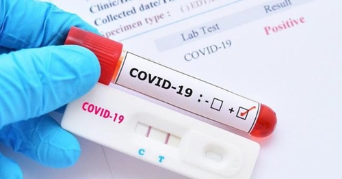 Hỗ trợ các nhà thuốc đăng ký bán test nhanh COVID-19