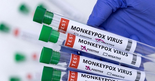WHO kêu gọi các nước chia sẻ dữ liệu về hiệu quả của vaccine phòng bệnh đầu mùa khỉ